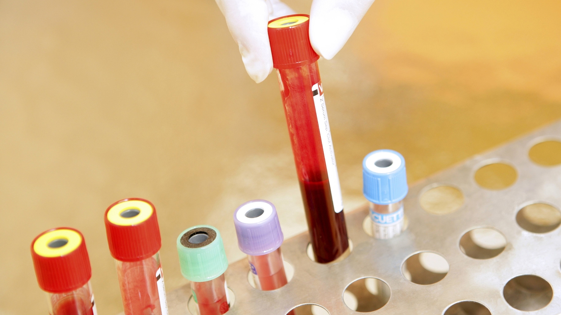 Сдать анализ крови на свёртываемость в Туле